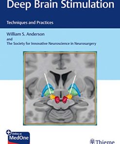 Deep Brain Stimulation: Techniques and Practices (PDF)
