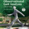 Observational Gait Analysis: A Visual Guide