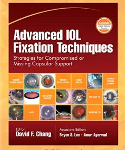 Advanced IOL Fixation Techniques: Strategies for Compromised or Missing Capsular Support (PDF)