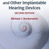 Cochlear Implants and Other Implantable Hearing Devices, 2nd Edition (PDF)