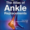 The Atlas of Ankle Replacements (PDF)