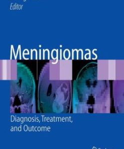 Meningiomas: Diagnosis, Treatment, and Outcome (PDF)