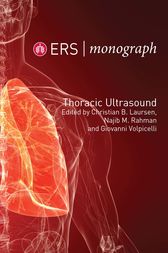 ERS Monograph 79: Thoracic Ultrasound (EPUB)