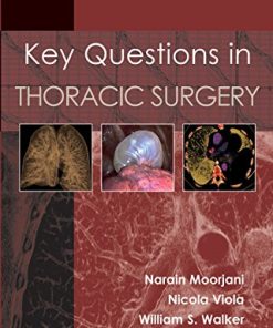 Key Questions in Thoracic Surgery (PDF)