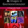 Clinical Challenges and Images in Gastroenterology: A Diagnostic Guide (PDF)