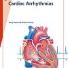 Fast Facts: Cardiac Arrhythmias (PDF Book)