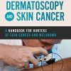 Dermatoscopy and Skin Cancer: A handbook for hunters of skin cancer and melanoma (PDF)