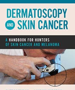 Dermatoscopy and Skin Cancer: A handbook for hunters of skin cancer and melanoma (PDF)