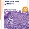 Fast Facts: Cutaneous T-cell Lymphoma (PDF)