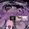 Gynecologic Cancers: A Multidisciplinary Approach to Diagnosis and Management