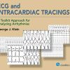 ECG and Intracardiac Tracings: A Toolkit Approach for Analyzing Arrhythmias (HQ PDF)