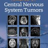 Imaging of Central Nervous System Tumors (ePub3+Converted PDF)