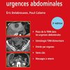 TDM des urgences abdominales (True PDF)