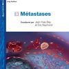 Métastases (Thérapie ciblée des cancers) (French Edition) (PDF Book)