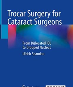 Trocar Surgery for Cataract Surgeons: From Dislocated IOL to Dropped Nucleus (PDF)