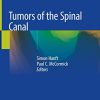 Tumors of the Spinal Canal (PDF Book)