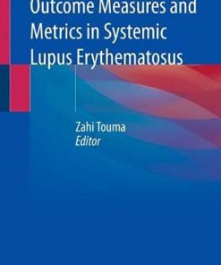 Outcome Measures and Metrics in Systemic Lupus Erythematosus (PDF)