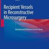 Recipient Vessels in Reconstructive Microsurgery: Anatomy and Technical Considerations (PDF Book)