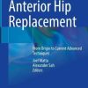 Anterior Hip Replacement: From Origin to Current Advanced Techniques (PDF)