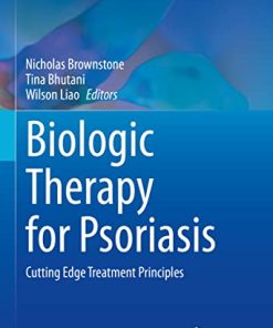 Biologic Therapy for Psoriasis: Cutting Edge Treatment Principles (Updates in Clinical Dermatology) (PDF Book)