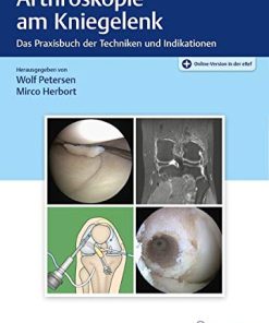 Arthroskopie am Kniegelenk (PDF)