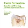 Caries Excavation: Evolution of Treating Cavitated Carious Lesions (Monographs in Oral Science, Vol. 27) (PDF)