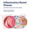 Fast Facts: Inflammatory Bowel Disease for Patients and their Supporters: Ulcerative colitis and Crohn’s disease Information + Taking Control = Best Outcome (PDF)