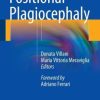Positional Plagiocephaly (PDF)