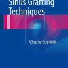 Sinus Grafting Techniques: A Step-by-Step Guide (EPUB)