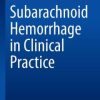 Subarachnoid Hemorrhage in Clinical Practice