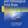 The Normal and Pathological Fetal Brain: Ultrasonographic Features (PDF)