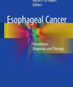 Esophageal Cancer: Prevention, Diagnosis and Therapy (PDF)