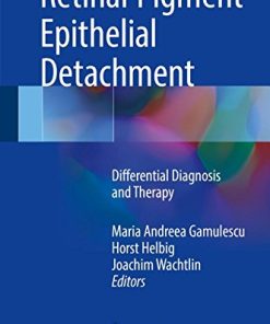 Retinal Pigment Epithelial Detachment: Differential Diagnosis and Therapy (PDF)