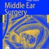 Middle Ear Surgery (PDF)