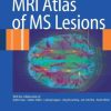 MRI Atlas of MS Lesions (PDF)
