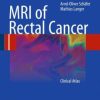 MRI of Rectal Cancer: Clinical Atlas (PDF)