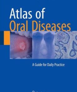 Atlas of Oral Diseases: A Guide for Daily Practice (PDF)