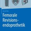 Femorale Revisionsendoprothetik (PDF)
