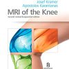 MRI of the Knee: Second revised & expanded edition (PDF)