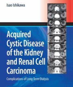 Acquired Cystic Disease of the Kidney and Renal Cell Carcinoma: Complication of Long-Term Dialysis (PDF)
