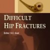 Difficult Hip Fracture – ECAB