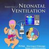 Essentials of Neonatal Ventilation (PDF Book)