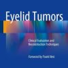 Eyelid Tumors: Clinical Evaluation and Reconstruction Techniques (PDF)