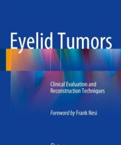 Eyelid Tumors: Clinical Evaluation and Reconstruction Techniques (PDF)