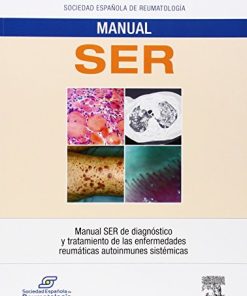 Manual SER de diagnóstico y tratamiento de las enfermedades reumáticas autoinmunes sistémicas