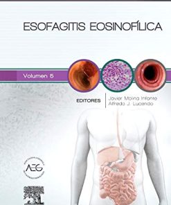 Esofagitis eosinofílica: Clínicas Iberoamericanas de Gastroenterología y Hepatología (Spanish Edition) (True PDF)