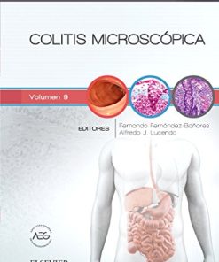 Colitis microscópica (Spanish Edition) (True PDF)