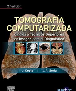 Tomografía computarizada dirigida a técnicos superiores en imagen para el diagnóstico (2ª ed.) (PDF)