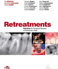 Retreatment. Solutions for apical diseases of endodontic origin (EPUB)