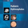 Pediatric Hydrocephalus (PDF)